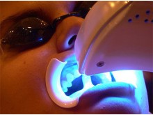 Ультрафиолет в стоматологии - зачем нужен зубам